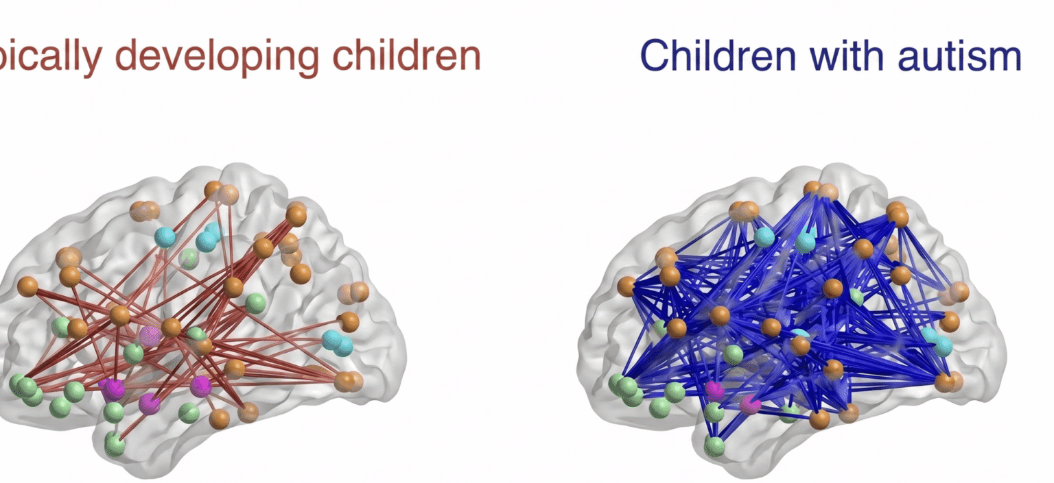 A side-by-side comparison of two brain network visualizations: on the left, a brain with connections colored red, labeled "pically developing children"; on the right, a brain with connections colored blue, labeled "Children with autism."